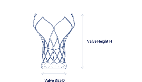 Aortic Valve