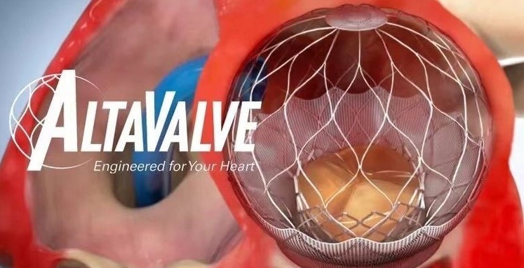 MicroPort<sup>®</sup> CardioFlow’s Strategic Partner 4C Medical Commences the Pivotal Clinical Trial for AltaValve™ Transcatheter Mitral Valve Replacement Device